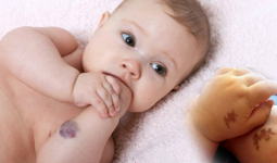 Bebeklerde Doğum Lekesi Neden Olur?